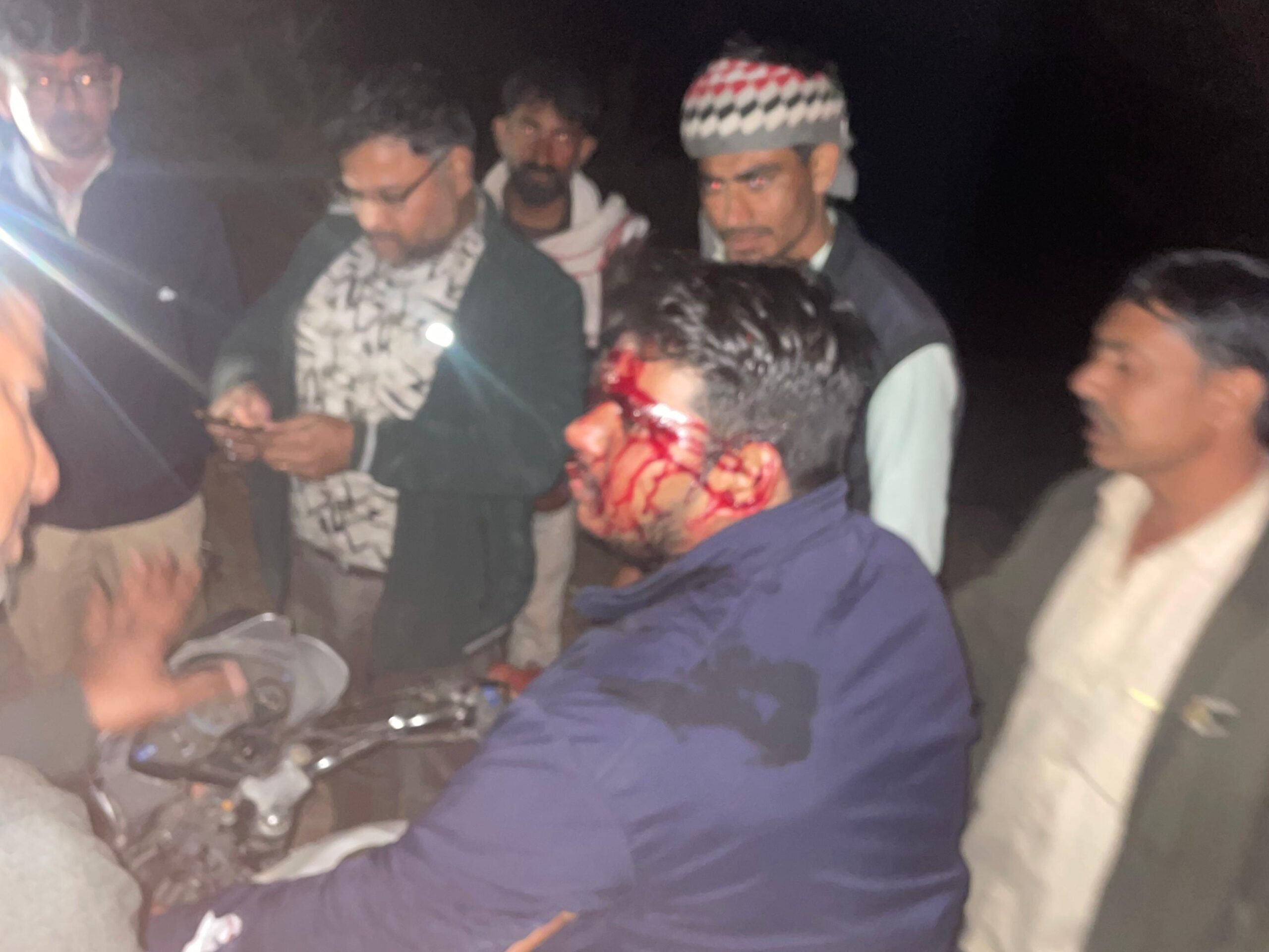 ब्रेकिंग न्यूज़: सातलेरा के पास बाइक स्लिप, युवक गंभीर घायल